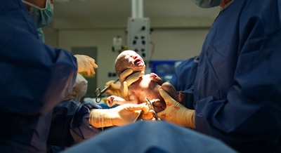 Pictures Of Women Giving Birth To A Child